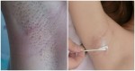 Nách hết thâm đen, tự tin diện bộ cánh yêu thích với 6 mẹo cực hay này
