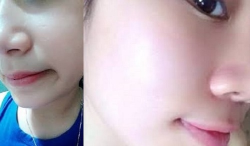 Dùng hỗn hợp này 15 phút/lần, da căng mịn trắng hồng hơn cả bôi kem sau 6 lần bôi
