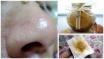 Cả đời không lo nặn mụn đầu đen nữa nhờ sử dụng đường trắng theo cách này