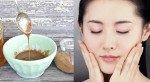 Tiết lộ "thần dược" được coi như kẻ thù của các loại mụn trên da bấy lâu nay