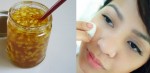 2 cách trị sẹo thâm trên da vĩnh viễn không hề tốn kém từ nhánh gừng