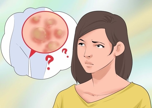 8 nguyên nhân khiến kinh nguyệt lúc có lúc không, là phụ nữ cần biết