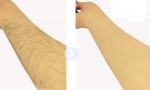 Tuyệt chiêu triệt sạch lông tay chân chẳng lo mọc lại chỉ với đậu nành và bột nghệ
