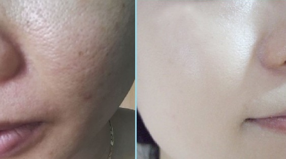 Da trắng dần lên nhờ 5 thực phẩm không ai ngờ tới trong bếp