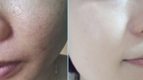 Da trắng dần lên nhờ 5 thực phẩm không ai ngờ tới trong bếp