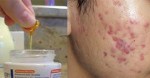 4 công dụng làm đẹp của Vitamin E nhất định bạn phải biết