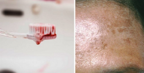 11 DẤU HIỆU MẤT CÂN BẰNG HÓC-MÔN NGUY HIỂM NHẤT TRONG CƠ THỂ, AI CŨNG NÊN BIẾT