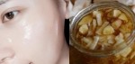 Thái tỏi thành lát mỏng rồi ngâm mật ong uống 2 lần/ngày, da căng mịn sáng lên tông chỉ sau 2 tuần