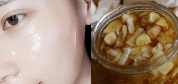 Thái tỏi thành lát mỏng rồi ngâm mật ong uống 2 lần/ngày, da căng mịn sáng lên tông chỉ sau 2 tuần
