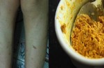 Da chi chít vết thâm đen cũng trở nên sáng mịn nhờ đắp hỗn hợp quen thuộc này