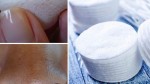 Tự chế miếng lột mụn từ 3 nguyên liệu siêu rẻ – lột đến đâu sạch mụn đến đấy