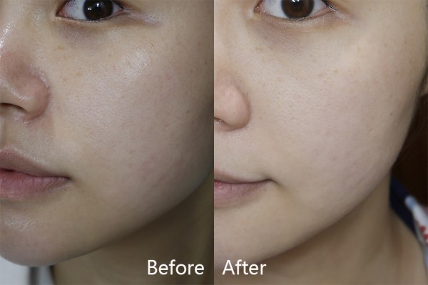 6 bước dưỡng da buổi tối giúp bạn lên đời nhan sắc ngon ơ