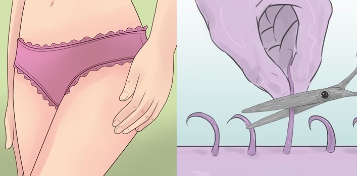 6 hiểu lầm thường gặp về "đồng cỏ" của cô bé