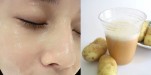 Thu nhỏ lỗ chân lông dễ dàng chỉ với những nguyên liệu NHÌN ĐÂU CŨNG THẤY