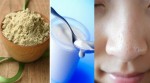 Bạn sẽ không bao giờ còn mụn đầu đen nữa nếu làm điều này mỗi ngày