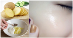 Cắt 1 lát mỏng khoai tây rồi chà lên nốt mụn, bạn sẽ bất ngờ với điều xảy ra