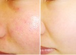 Ngăn chặn lão hóa, dưỡng trắng da nhờ nước vo gạo