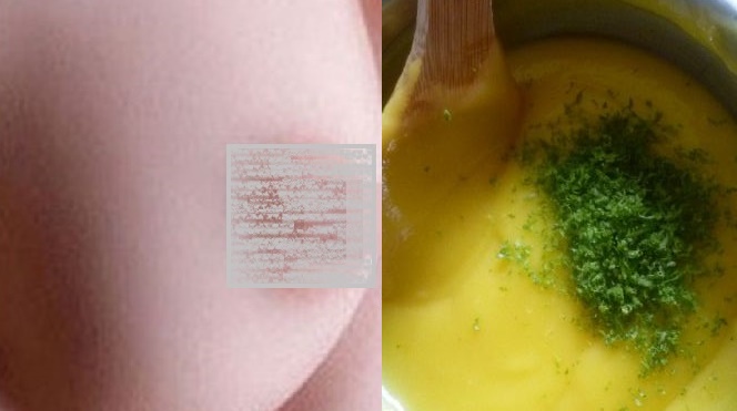 Nhũ hoa từ thâm đen đã trở nên hồng hào thế nào