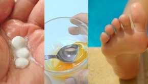 8 công dụng làm đẹp không ngờ của aspirin nhất định bạn phải biết