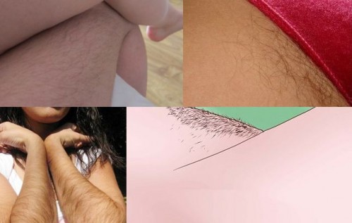 Đây là lý do khiến vi ô lông chị em mọc rậm rạp bất thường