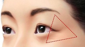 “Vết chân chim” hoàn toàn biến mất chỉ với 4 nguyên liệu nhà bếp