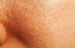 Se khít lỗ chân lông với công thức tuyệt vời chỉ trong vòng 20 phút