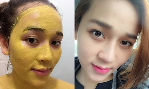 Giã củ này rồi thoa lên da, sẹo, mụn, thâm lâu năm cũng tự chui ra hết, da lại trắng mướt, mềm mịn
