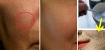 Công thức đơn giản loại bỏ lỗ chân lông to trên mặt