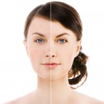 6 thói quen ai cũng dễ mắc phải khiến da bị mụn