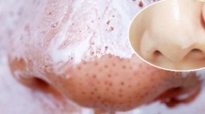 Thoa kem đánh răng lên mặt trong 5 phút, bạn sẽ bất ngờ với kết quả có được
