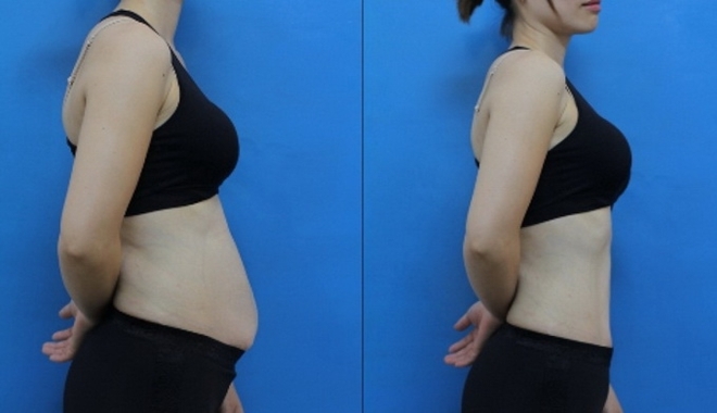 Thực đơn đầy đủ giúp bạn giảm nhẹ nhàng 8kg chỉ trong 14 ngày