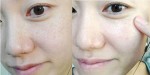 Trị sạch nám và tàn nhang đáng ghét nhờ 2 thực phẩm có sẵn trong bếp
