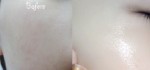 Sạch mụn hết thâm, da mướt rượt mịn màng nhờ hỗn hợp đơn giản này