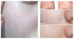Mặt nạ se khít lỗ chân lông: làm 1 lần, dùng 1 tuần lỗ chân lông nhỏ đi sau 1 tháng