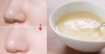 8 Cách tự nhiên giúp xóa sạch lỗ chân lông to trên da vĩnh viễn