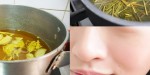 Xông hơi với Sả + Chanh + Gừng 1 tuần 2 lần, mụn hết sạch, da trắng mịn siêu tốc
