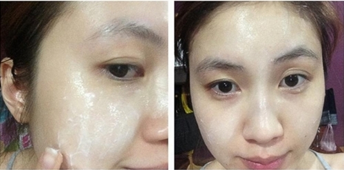 Trộn 2 thứ này lại với nhau rồi thoa lên da 15 phút, mụn tự chui ra, nám da mờ dần