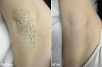 Trộn nước cốt chanh với giấm rồi thoa lên nách, mùi hôi kinh niên cũng phải khỏi ngay sau lần đầu tiên