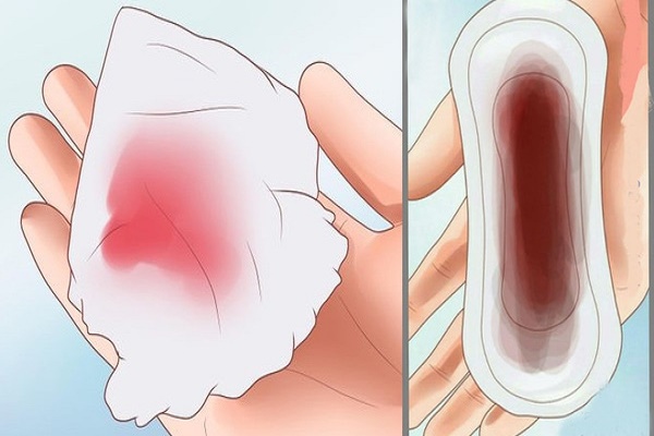 Nếu thấy ra kinh nguyệt ra máu màu đen, chị em đừng âm thầm chịu đựng