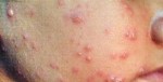 CẢNH BÁO: Nếu đột ngột có 8 dấu hiệu này trên khuôn mặt, hãy đi khám cấp tốc!