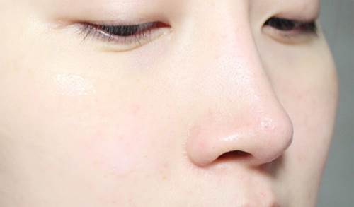 Có hỗn hợp "thần thánh này", da đen bẩm sinh cũng trở nên trắng lên sau 3 tuần