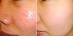 "Soi kính lúp mới thấy lỗ chân lông” - bí kíp này khiến bạn ngỡ ngàng sau 1 tuần với làn da của mình