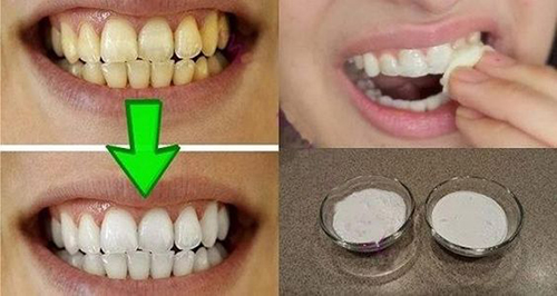 1 nhúm muối và 2 công thức làm răng trắng bóng không ê buốt