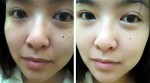 Chuẩn bị 1 quả dưa chuột, 1 chén nước chè rồi làm thế này, da trắng bóc, nám mờ dần
