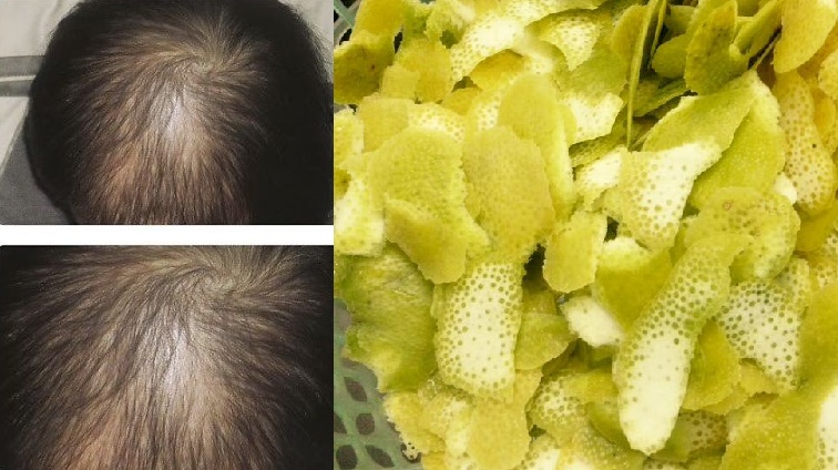 Cách sử dụng tinh dầu bưởi kích thích mọc tóc, dưỡng tóc khỏe đẹp, mượt mà không lo gãy rụng