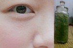 Da sạch mụn và trắng bóc từ đầu đến chân chỉ với nha đam ngâm giấm