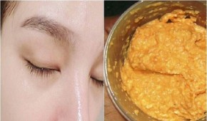 9 loại mặt nạ tự nhiên, đắp đến đâu da giảm mụn đến đó, bạn nên thử ngay