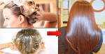 Rụng tóc, gàu, ngứa da đầu tất cả sẽ hết ngày chỉ với hỗn hợp này