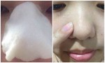 Đắp miếng bông tẩm thứ này lên mũi trong 5 phút sẽ giúp se khít lỗ chân lông, đẹp da