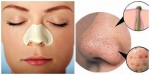 Cách lột mụn đầu đen SIÊU NHANH chỉ bằng 1 quả trứng